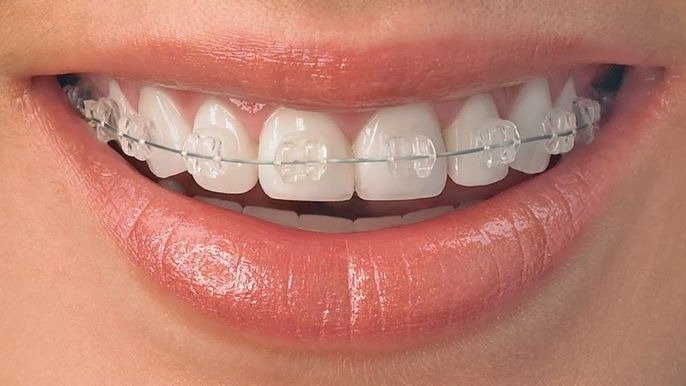 Orthodontic